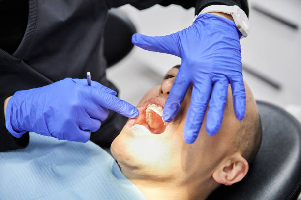 Best Emergency Dentist for Knocked-Out Tooth in Newton Falls, OH